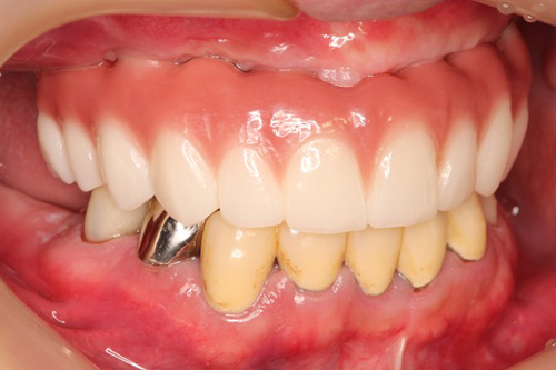 施術後 after 画像