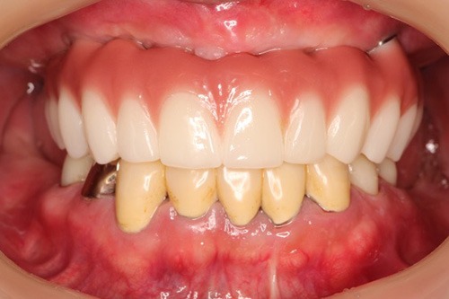 施術後 after 画像