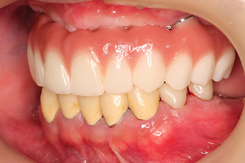 施術後 after 画像