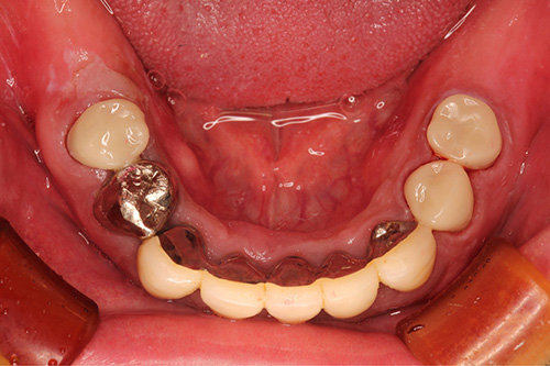 施術後 after 画像