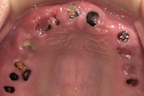 施術前 before 画像