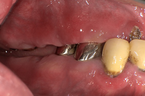 施術前 before 画像