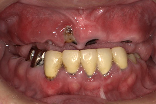 施術前 before 画像