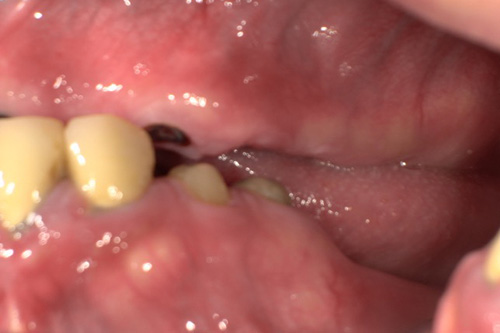 施術前 before 画像