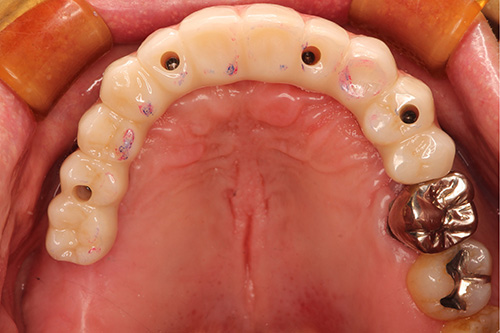 施術後 after 画像