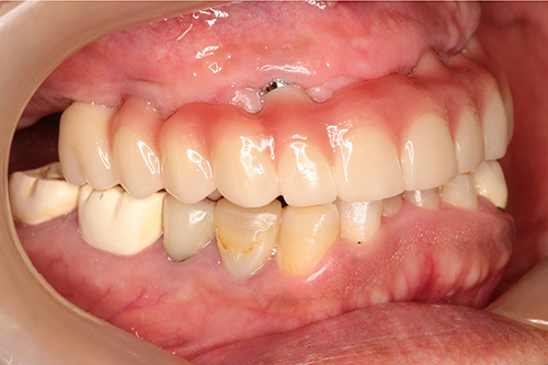 施術後 after 画像