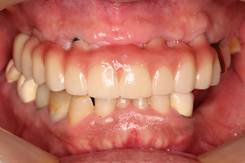 施術後 after 画像