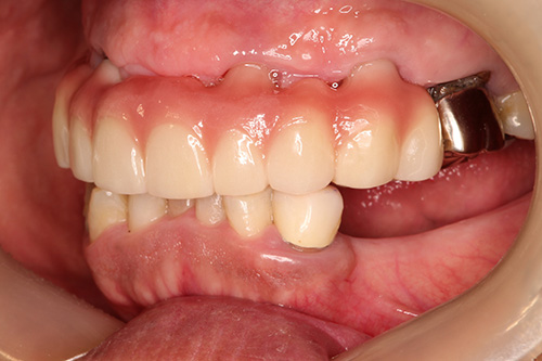 施術後 after 画像