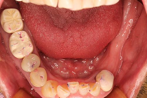 施術後 after 画像