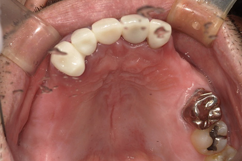 施術前 before 画像