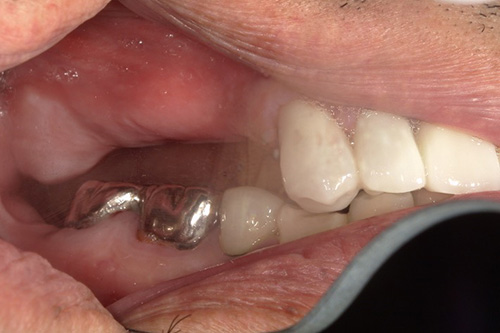 施術前 before 画像