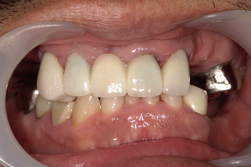 施術前 before 画像