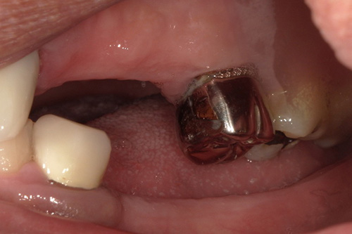 施術前 before 画像