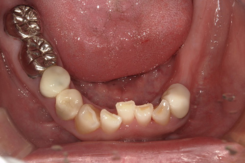 施術前 before 画像