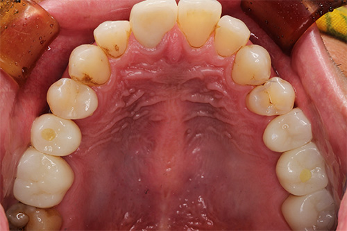 施術後 after 画像