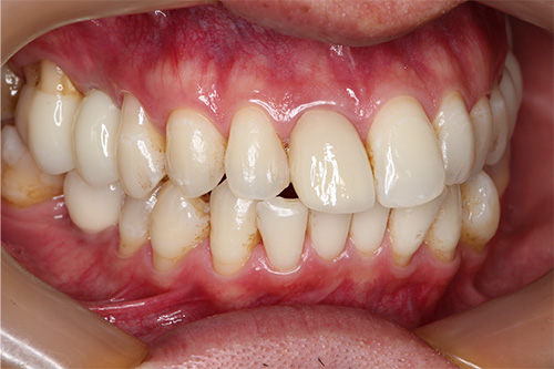 施術後 after 画像