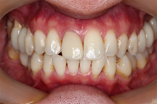 施術後 after 画像