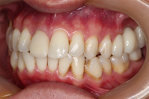 施術後 after 画像