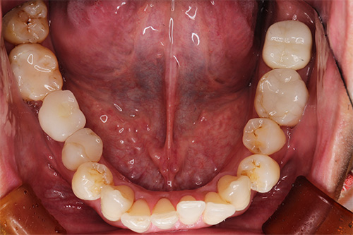 施術後 after 画像