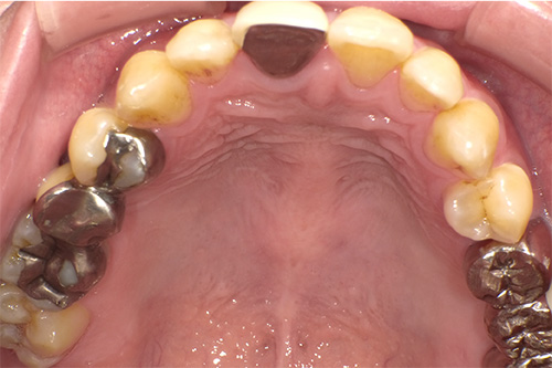 施術前 before 画像