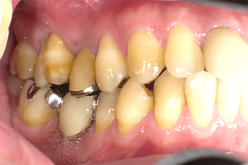 施術前 before 画像