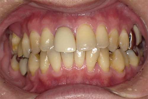 施術前 before 画像