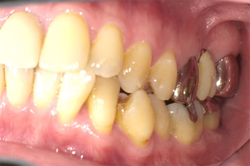 施術前 before 画像