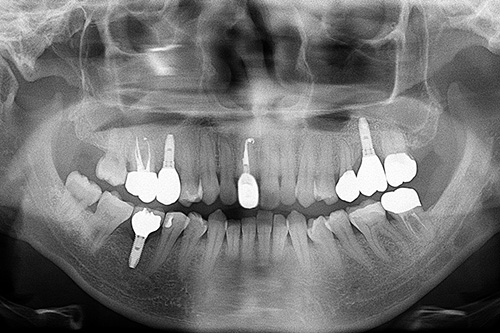 施術後 after 画像