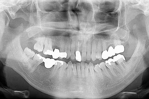 施術前 before 画像