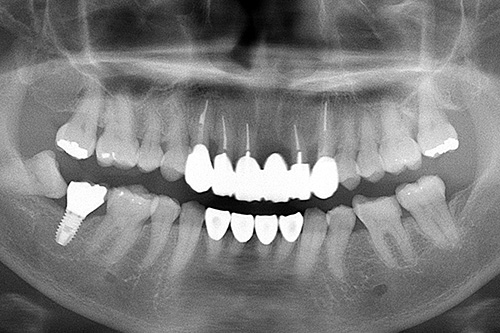 施術後 after 画像
