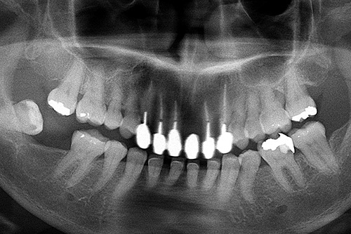 施術前 before 画像